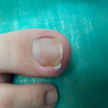 Анна Ткаченко, Харьков Фото - 6