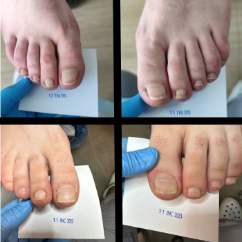 Тетяна Волошина, Одеса Фото - 5