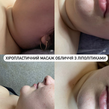 Міофасціальний масаж обличчя
                    Косметолог Виктория Харьков
