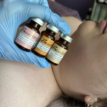 Липолитики
                    Косметолог Виктория Харків