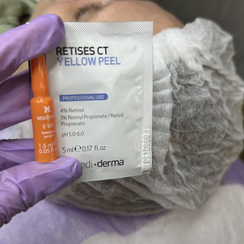 Хімічний пілінг
                    Косметолог Виктория Харьков