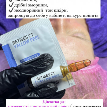 Хімічний пілінг
                    Косметолог Виктория Харьков