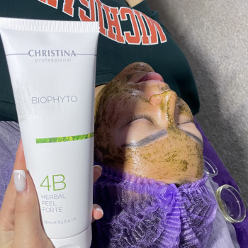 Хімічний пілінг
                    Косметолог Виктория Харьков