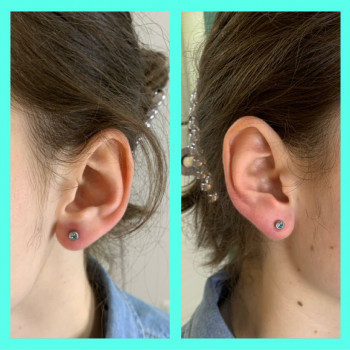 Пірсинг вушок