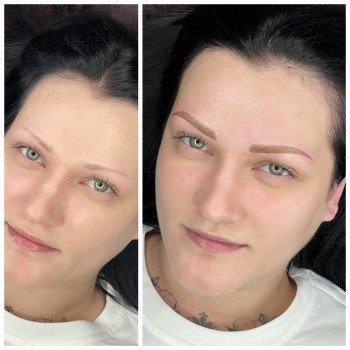 Пудрова краса відразу після процедури