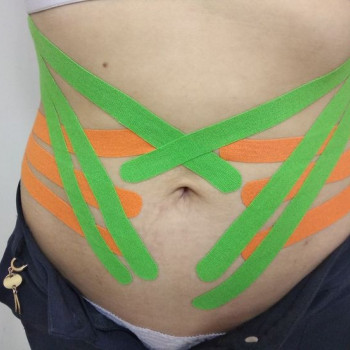 Тейпування тіла
                    Масажист Іван Львів