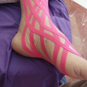 Тейпування тіла
                    Масажист Іван Львів