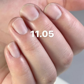 Анна Подолян, Вінниця Фото - 6