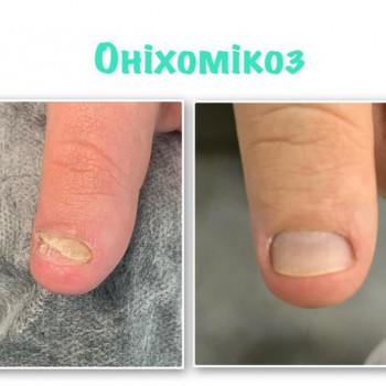 Елена Галимова, Черновцы Фото - 5