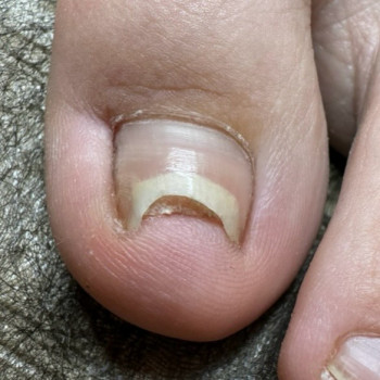 Дарʼя Пінчук, Запоріжжя Фото - 5