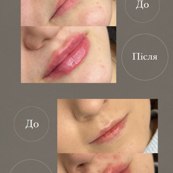 Фото з портфоліо косметолога Софія Бондар (Львів)