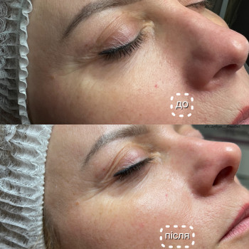 Фото з портфоліо косметолога Софія Бондар (Львів)