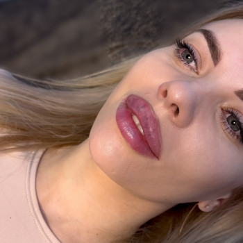 Контурная пластика губ