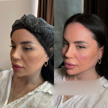 Четкие линии нижней челюсти