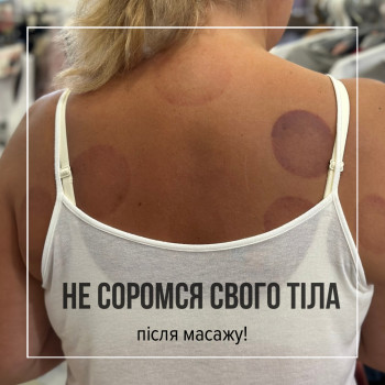 Вакуумний Масаж банками в Кременчуці
                    Салон красоты Імперія краси Кременчуг
