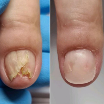 Марина Войтешенко, Чернигов Фото - 5