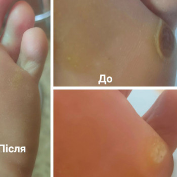 Ольга Москаленко, Чернігів Фото - 5