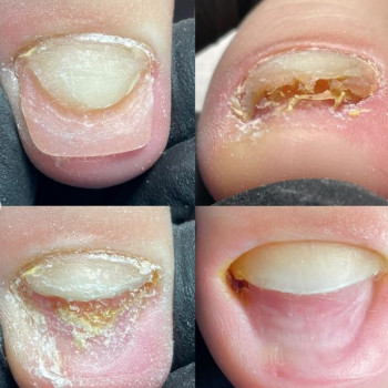 Наталія Вражевська, Київ Фото - 6