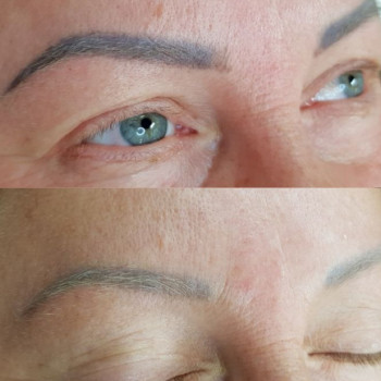 Видалення тату і татуажу лазером
                    Тату майстер Елена Київ