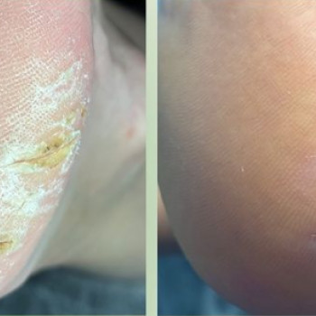 Ирина Стеценко, Черкассы Фото - 7