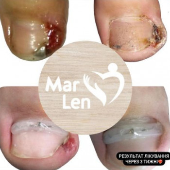 Олена , Черкаси Фото - 5