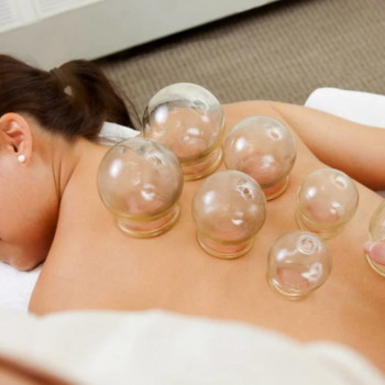 Постановка банок на точьки