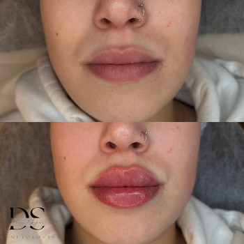 Диана Скоркина, Харьков Фото - 29