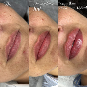 Диана Скоркина, Харьков Фото - 30