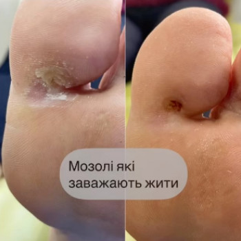 Ольга Авраменко, Івано-Франківськ Фото - 5