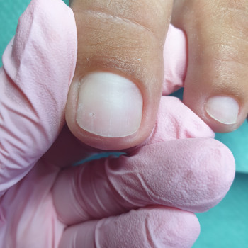 Анна Кифоренко, Кропивницький Фото - 1