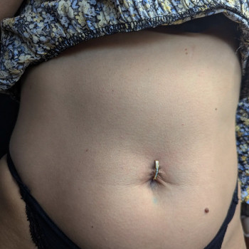 Прокол пупка   