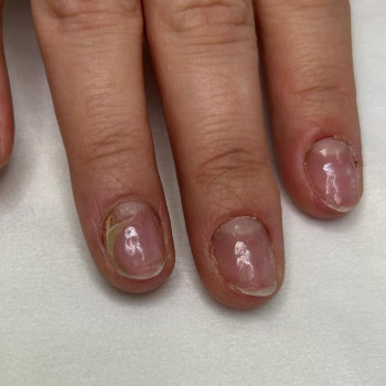 Анна Федоров, Ивано-Франковск Фото - 5