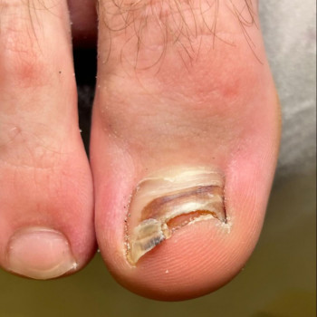 Анна Федоров, Ивано-Франковск Фото - 6