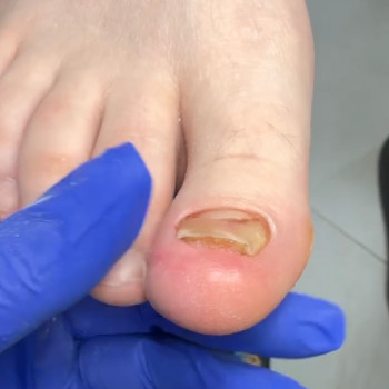 Ілона Фіх, Івано-Франківськ Фото - 6