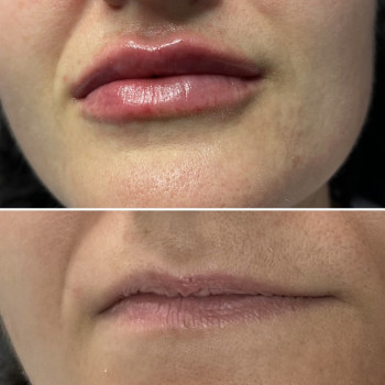 Анна Ваврик, Миколаїв Фото - 1