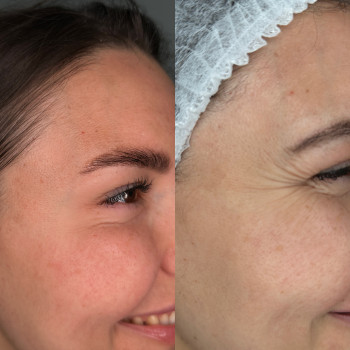 Диана Скоркина, Харьков Фото - 11