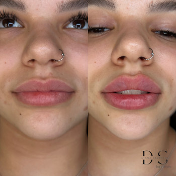 Диана Скоркина, Харьков Фото - 13