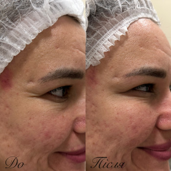 Диана Скоркина, Харьков Фото - 16