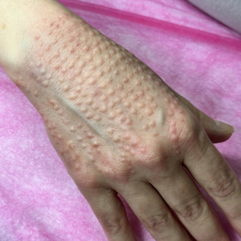 Руслана Мицней, Черновцы Фото - 80