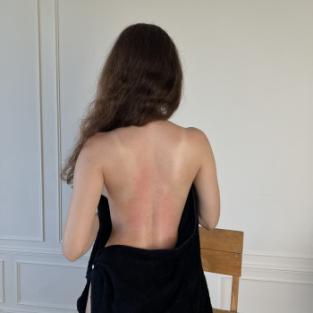 Фото з портфоліо фахівця Тетяна Шарлай (реабілітолог, Полтава)