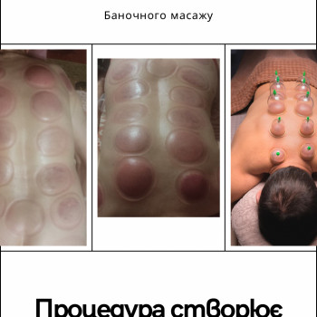Вакуумний Масаж банками в Кременчуці
                    Салон красоты Імперія краси Кременчуг