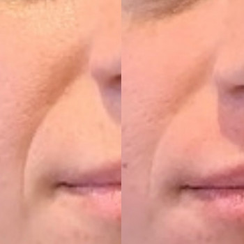 Алла Тимченко, Білогородка Фото - 8