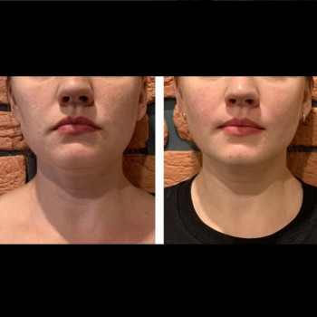 Алла Тимченко, Білогородка Фото - 5