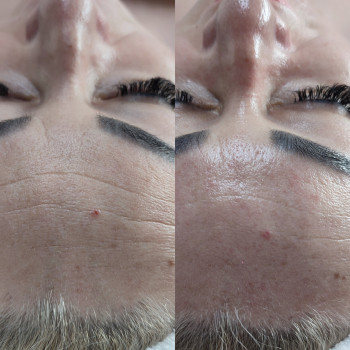 Рідка плазма