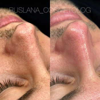 Руслана Хворостенко, Черкаси Фото - 12