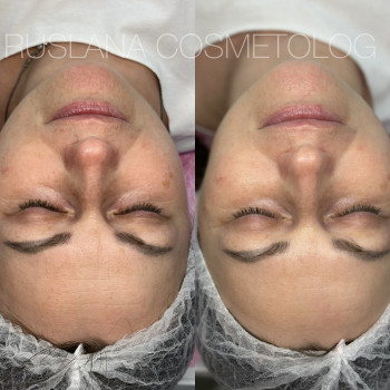 Руслана Хворостенко, Черкаси Фото - 13