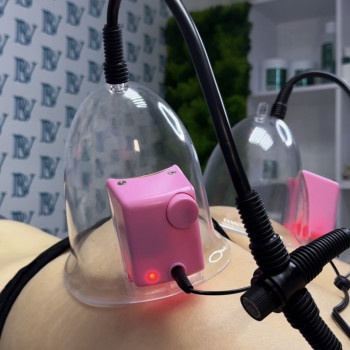 BV zone, Кривий Ріг Фото - 7