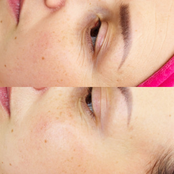 Доглядова процедура Martix Active