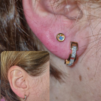 Пірсинг мочки вуха