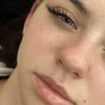 Айя Стратій, Вінниця Фото - 5